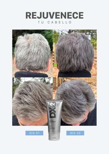 DX2 Shampoo Anti-Canas para Hombres